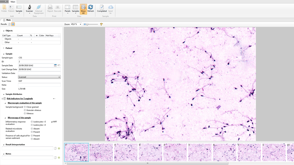 Vision Cyto Sperm Sediment