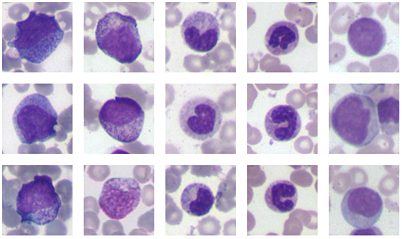 Analyse von pathologischen und komplexen Zellen