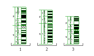 An adjustable reference guide for ideograms