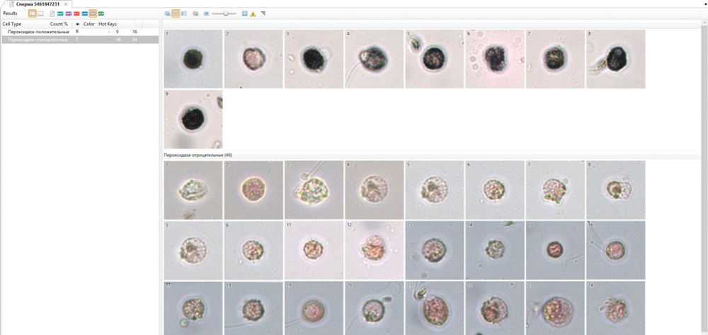 Leucocytes